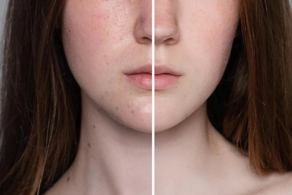 Sabah ve Akşam Kullanıma Uygun Cilt Bakım Rutinleri: Veela Pigment Correcting Cream ile Işıldayan Cilt