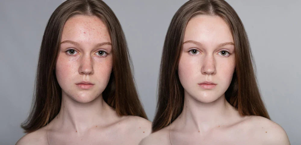 Bitkisel Özlerle Doğal Cilt Bakımı: Veela Pigment Correcting Cream