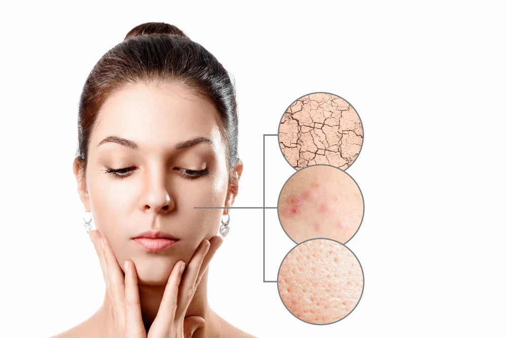 5 Moleküllü Hyaluronik Asit ile Derinlemesine Nemlendirme: Cildinize Gerçek Nem Terapisi